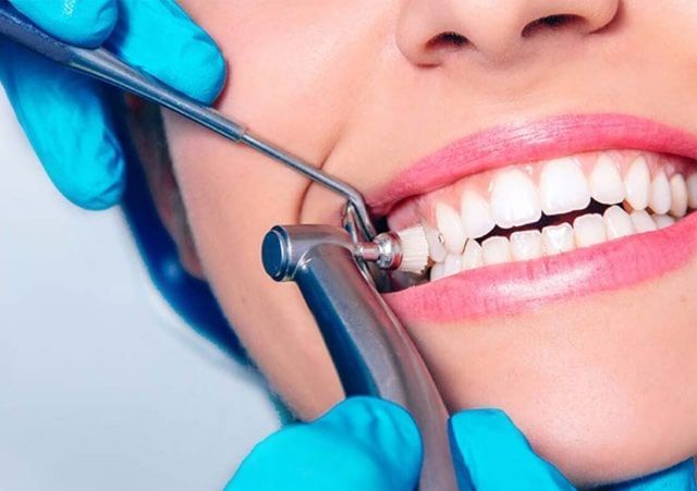 Dental Cleaning